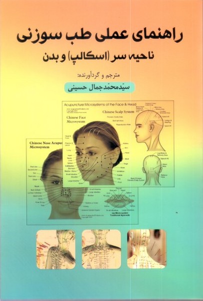 راهنمای عملی طب سوزنی ناحیه سر (اسکالپ) و بدن