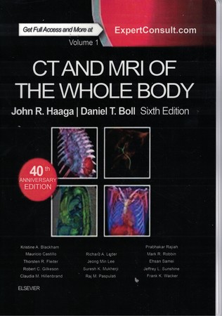 CT and MRI of the Whole Body (2-Volume - 6th Edition)