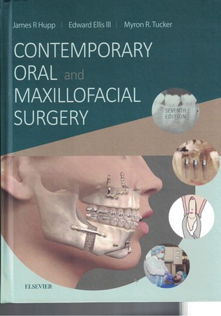 Contemporary oral and maxillofacial surgery
