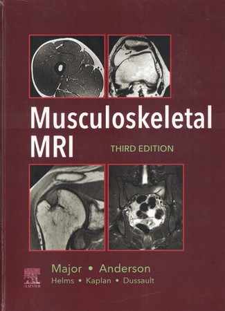 Musculoskeletal