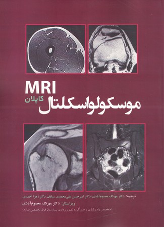 ترجمه کامل موسکولواسکلتال MRI کاپلان 2020