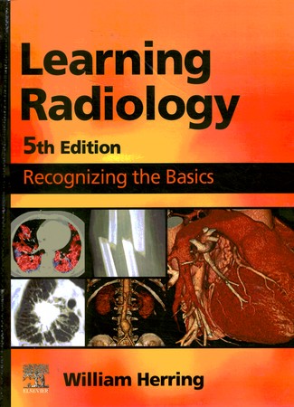 Learning Radiology: Recognizing the Basics 5th Edición