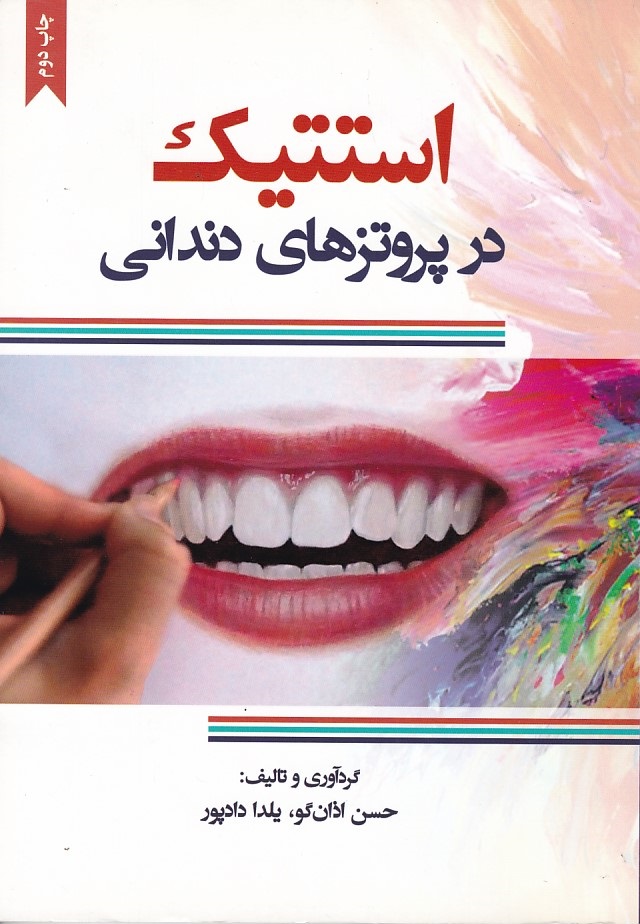 استتیک در پروتزهای دندانی 