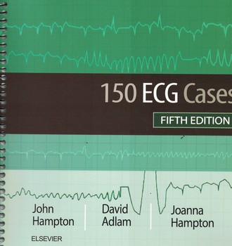 150ECG Cases - Fifth Edition 