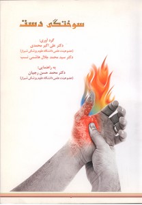 سوختگی دست